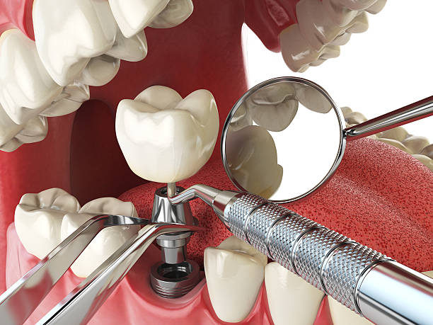 Best Emergency Denture Repair in Crab Orchard, WV